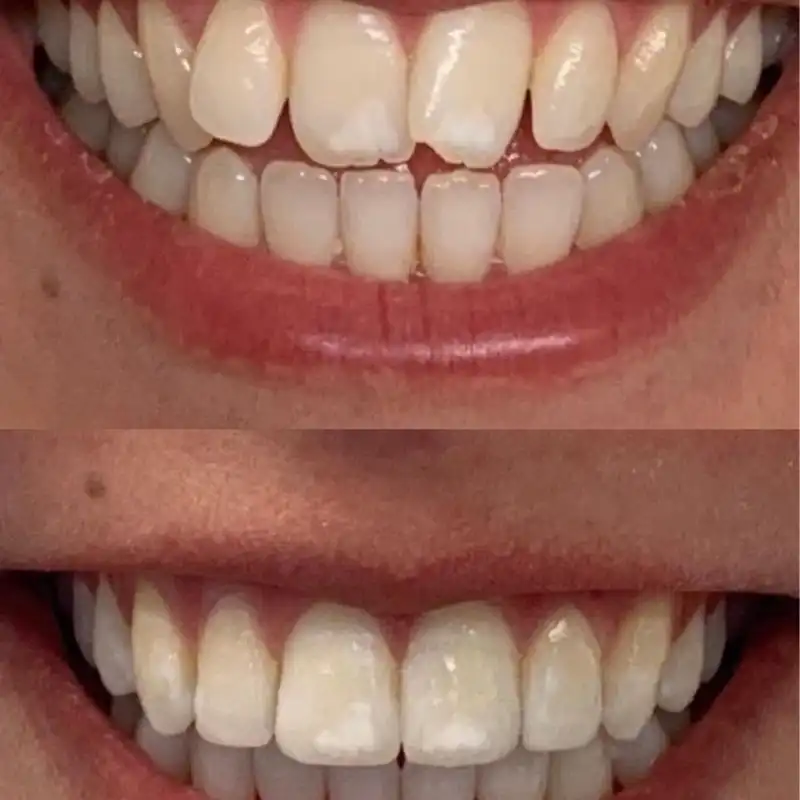 Hanham Dental Smile Gallery