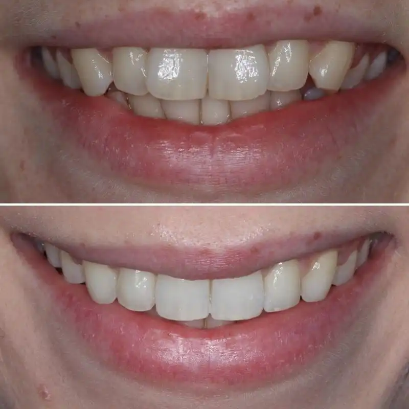 Hanham Dental Smile Gallery