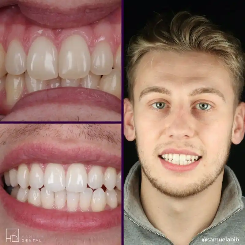 Hanham Dental Smile Gallery