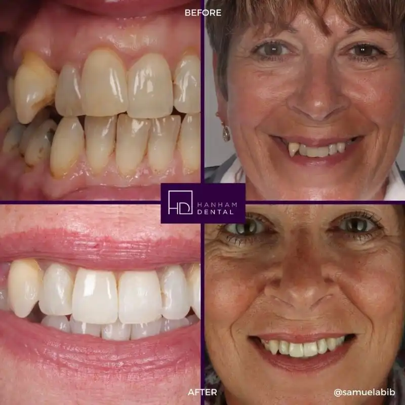 Hanham Dental Smile Gallery