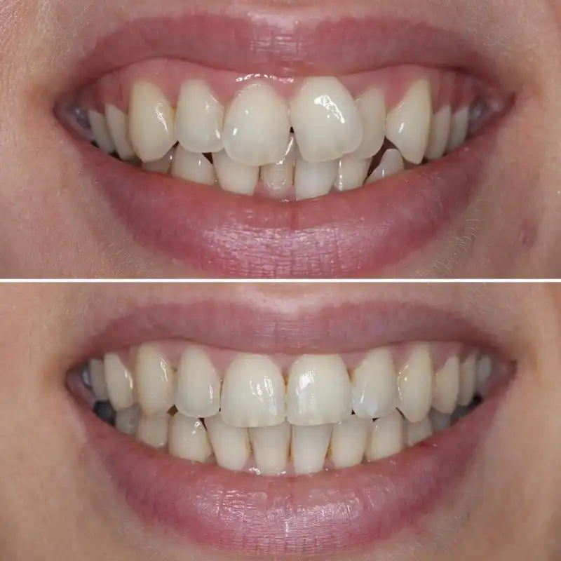 Hanham Dental Smile Gallery