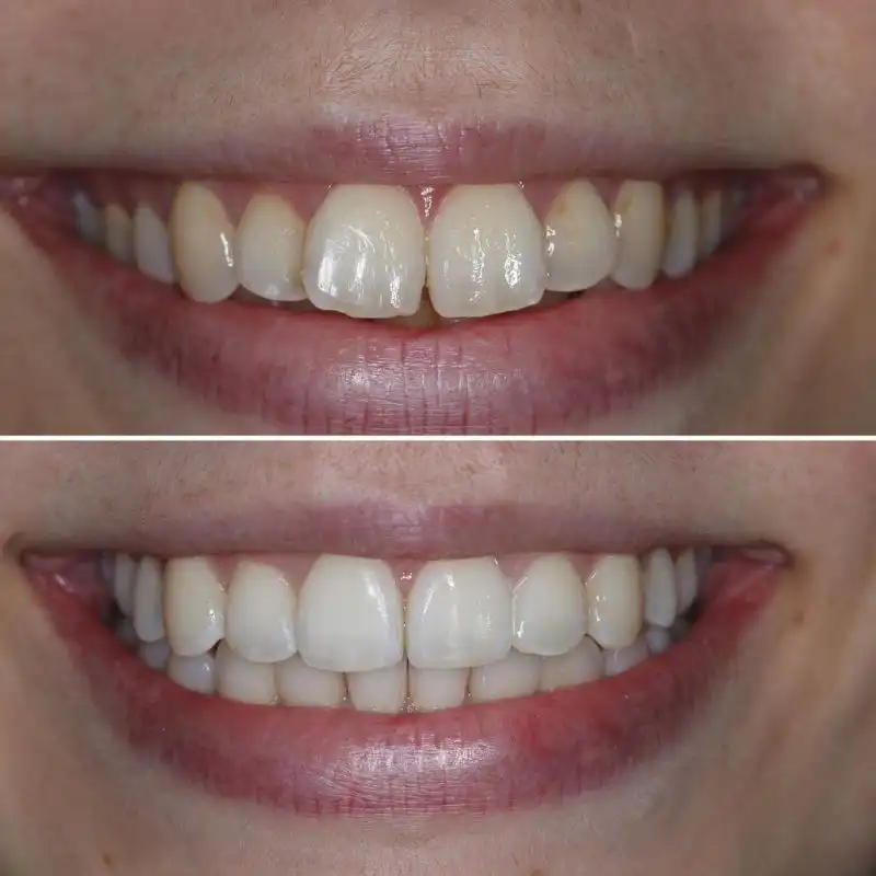 Hanham Dental Smile Gallery