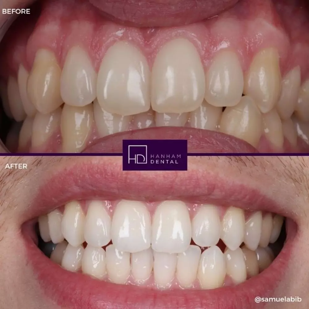 Hanham Dental Smile Gallery