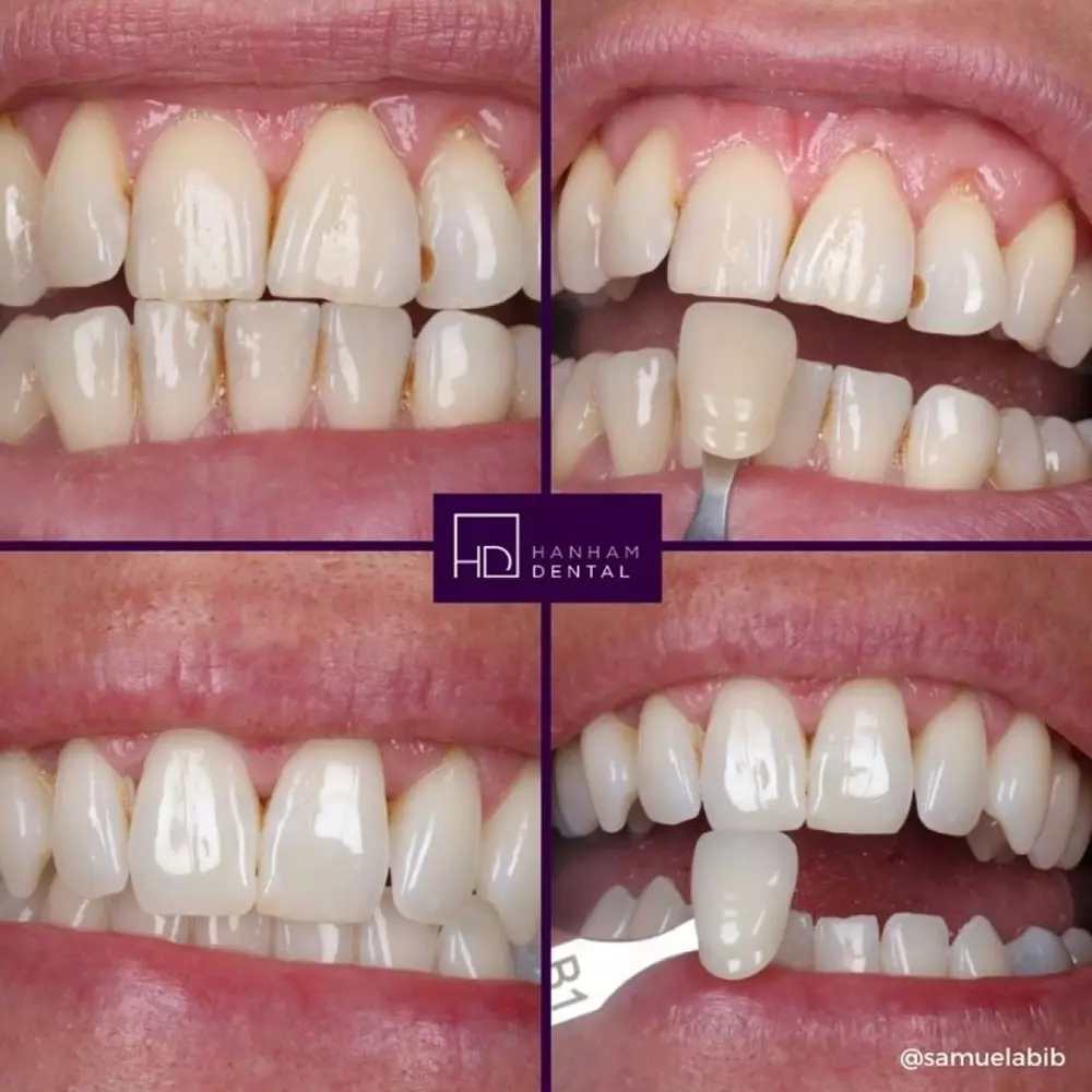 Hanham Dental Smile Gallery