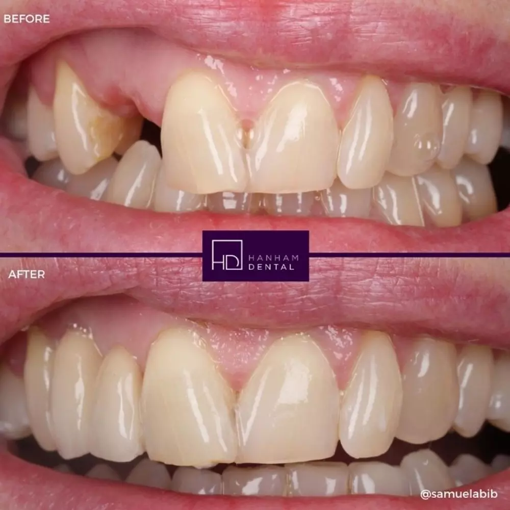 Hanham Dental Smile Gallery