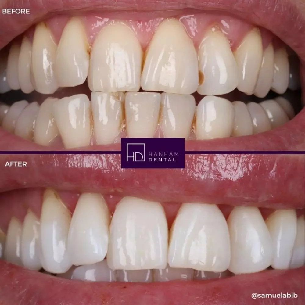 Hanham Dental Smile Gallery