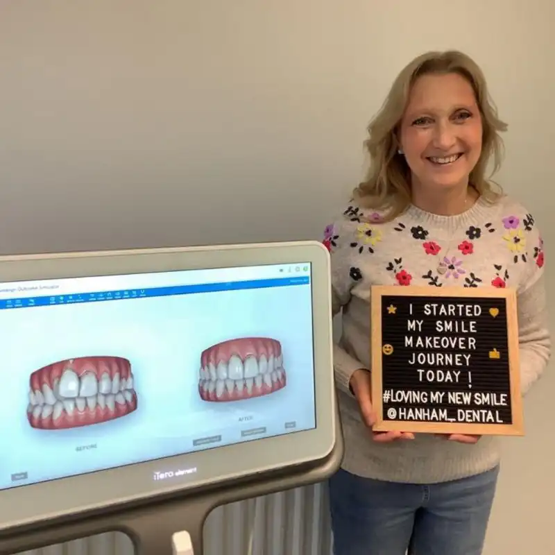 Hanham Dental Smile Gallery