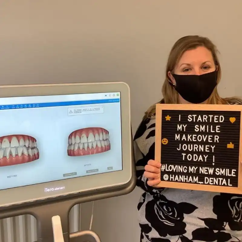 Hanham Dental Smile Gallery