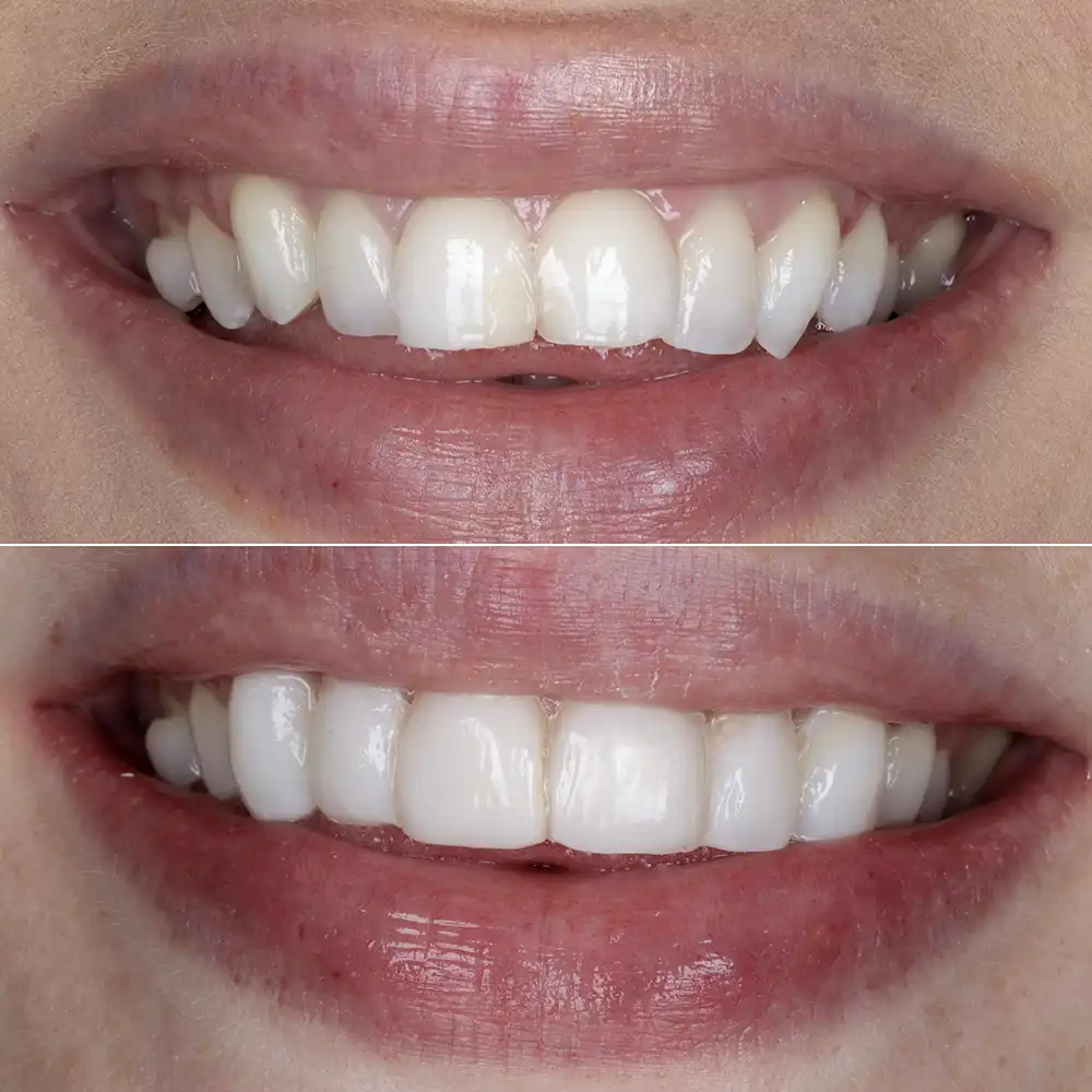 Hanham Dental Smile Gallery