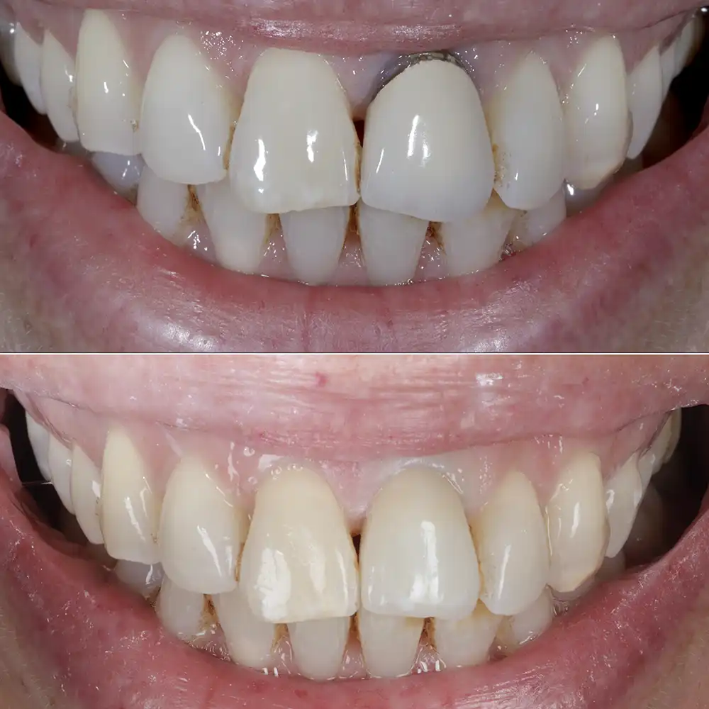 Hanham Dental Smile Gallery