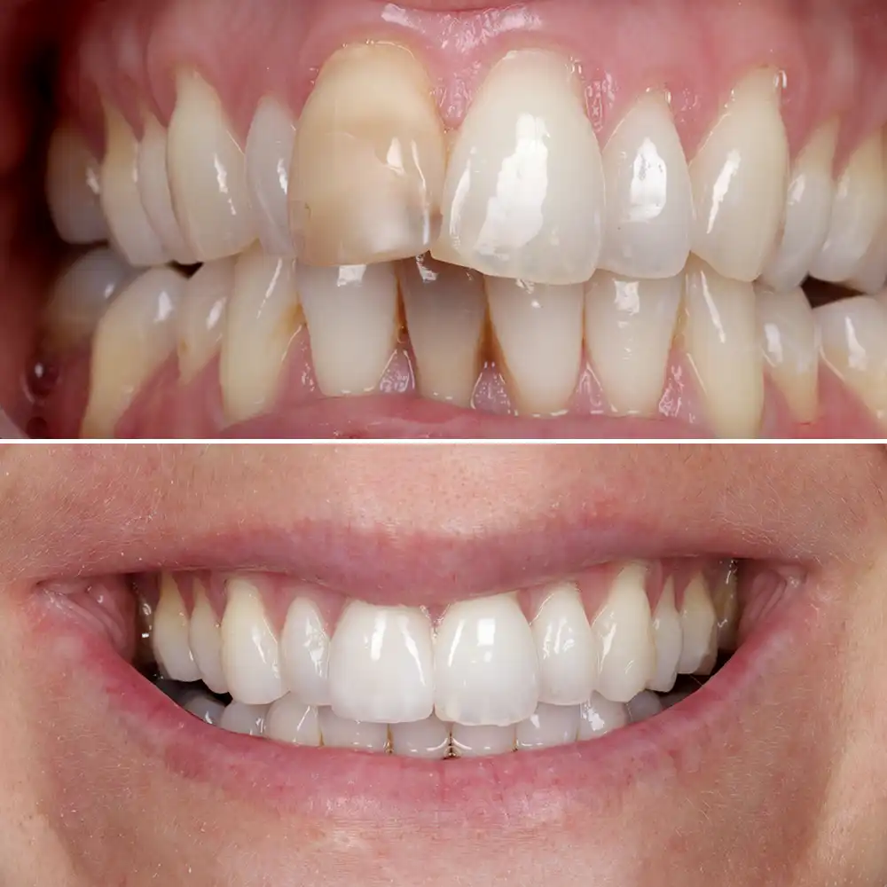 Hanham Dental Smile Gallery