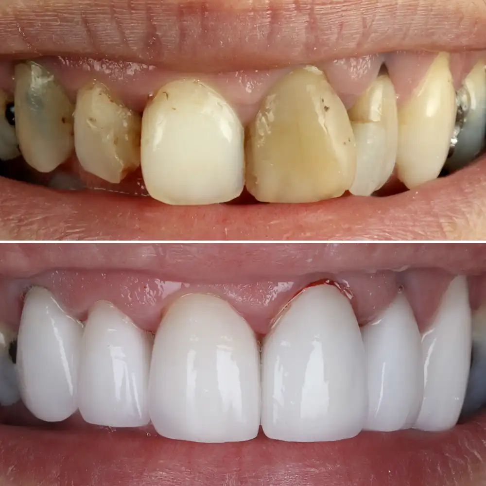 Hanham Dental Smile Gallery