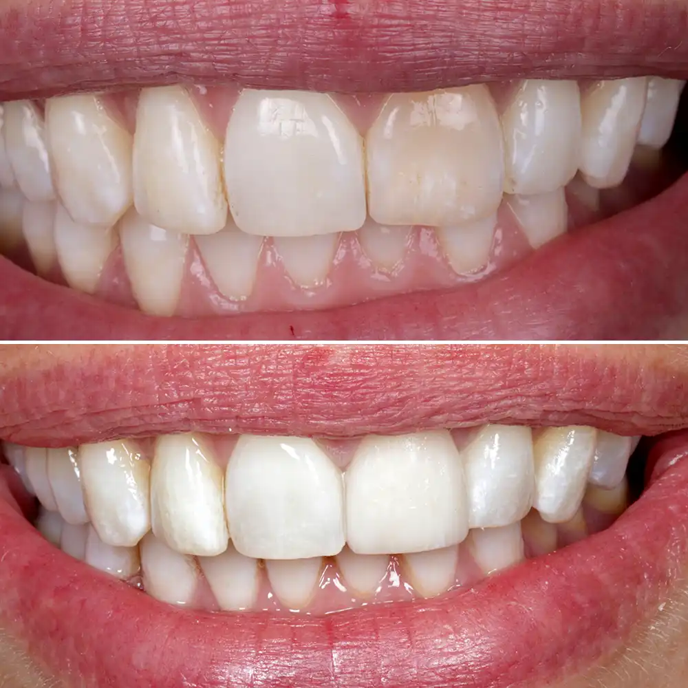 Hanham Dental Smile Gallery