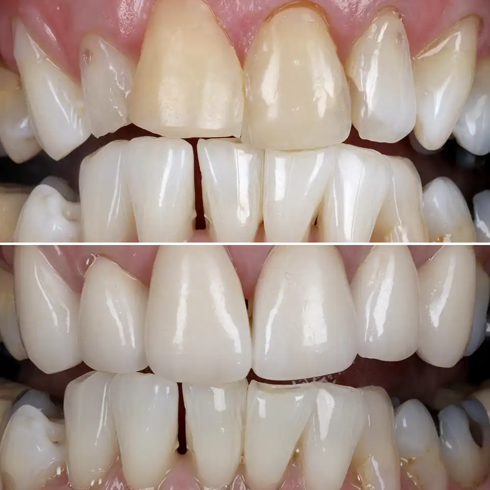 Hanham Dental Smile Gallery